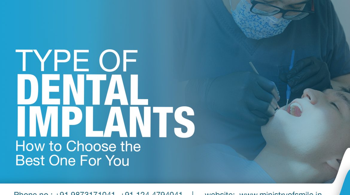 Type of Dental Implants – How to Choose the Best One For You?