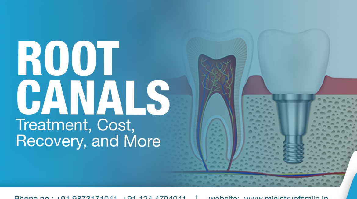 Root Canal: Treatment, Recovery, Cost, and More