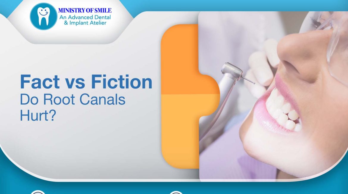 Fact vs Fiction: Do Root Canals Hurt?