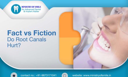 Fact vs Fiction: Do Root Canals Hurt?