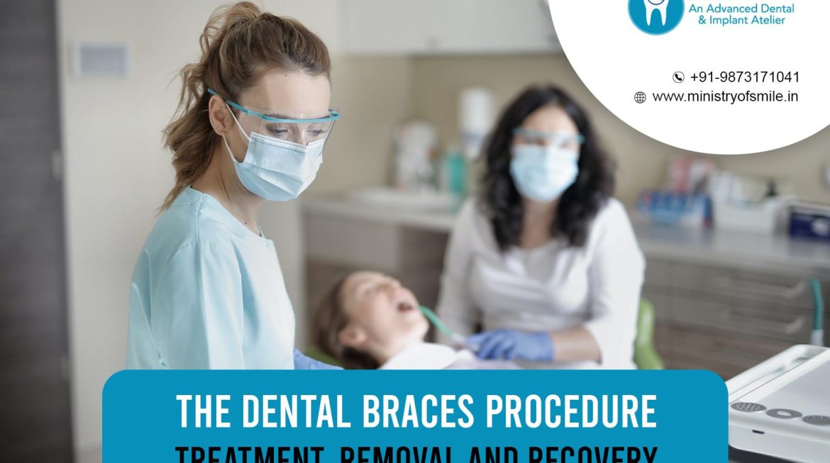 The Dental Braces Procedure: Treatment, Removal, And Recovery