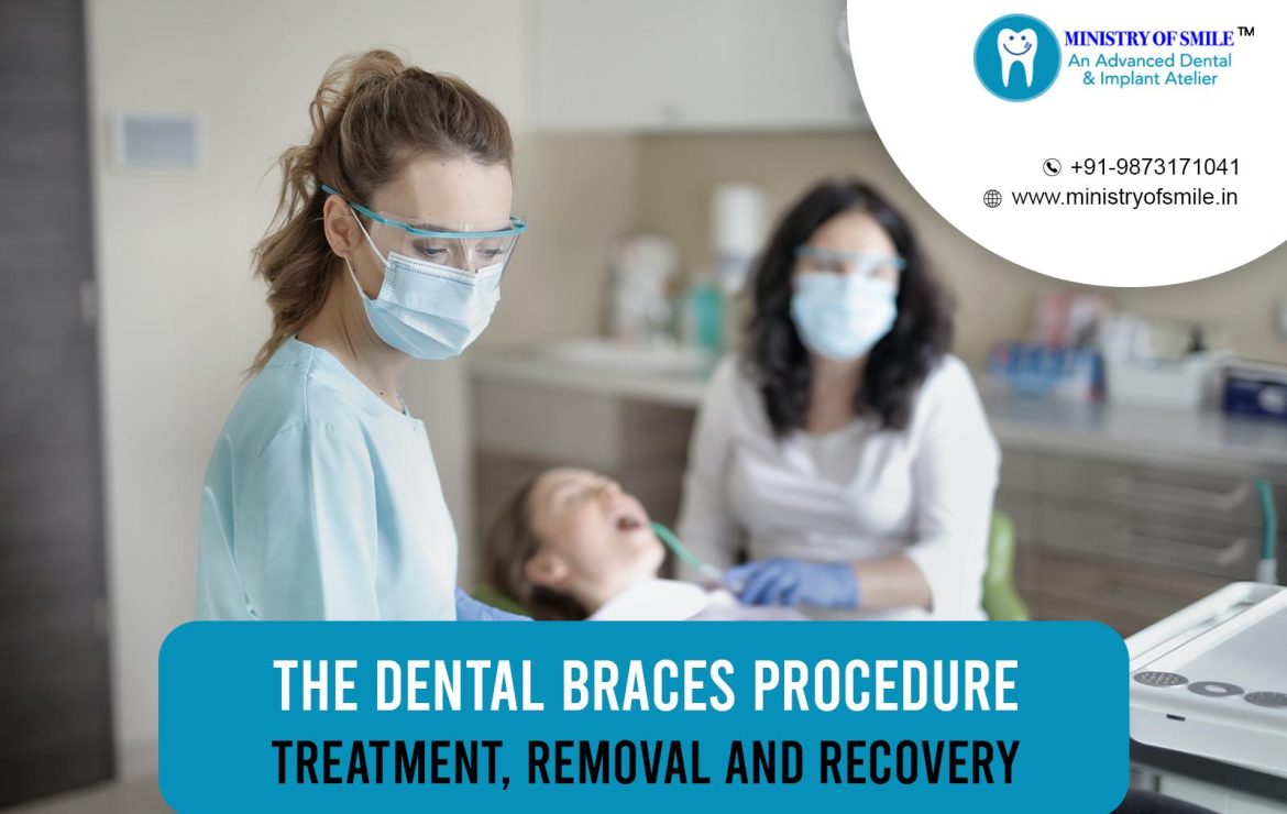 The Dental Braces Procedure: Treatment, Removal, And Recovery