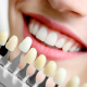 Best Teeth Whitening in Gurgaon