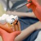 Painless Laser Root Canal Treatment in Gurgaon