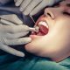 Best Dentist in Gurgaon for Root Canal Treatment