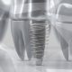 The Future of Dental Implants: Advancements and Innovations