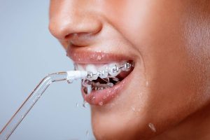 Flossing vs. Water Flossers: Which Is Better for You?