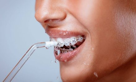 Flossing vs. Water Flossers: Which Is Better for You?