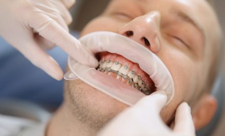 Best Orthodontist in Gurgaon