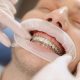 Best Orthodontist in Gurgaon