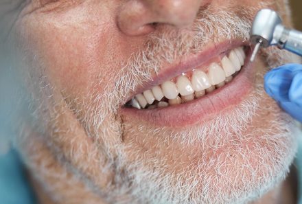 Dental Implants in Elderly Patients