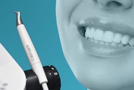Painless Teeth Cleaning with Airflow Technology
