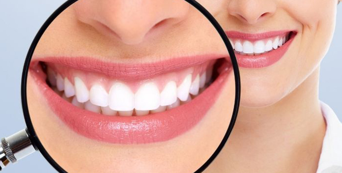 How to Get a Sparkling White Smile in One Sitting