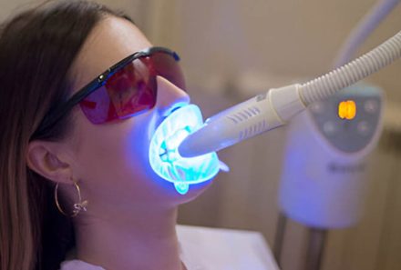 Not Everyone Is a Candidate for Whitening