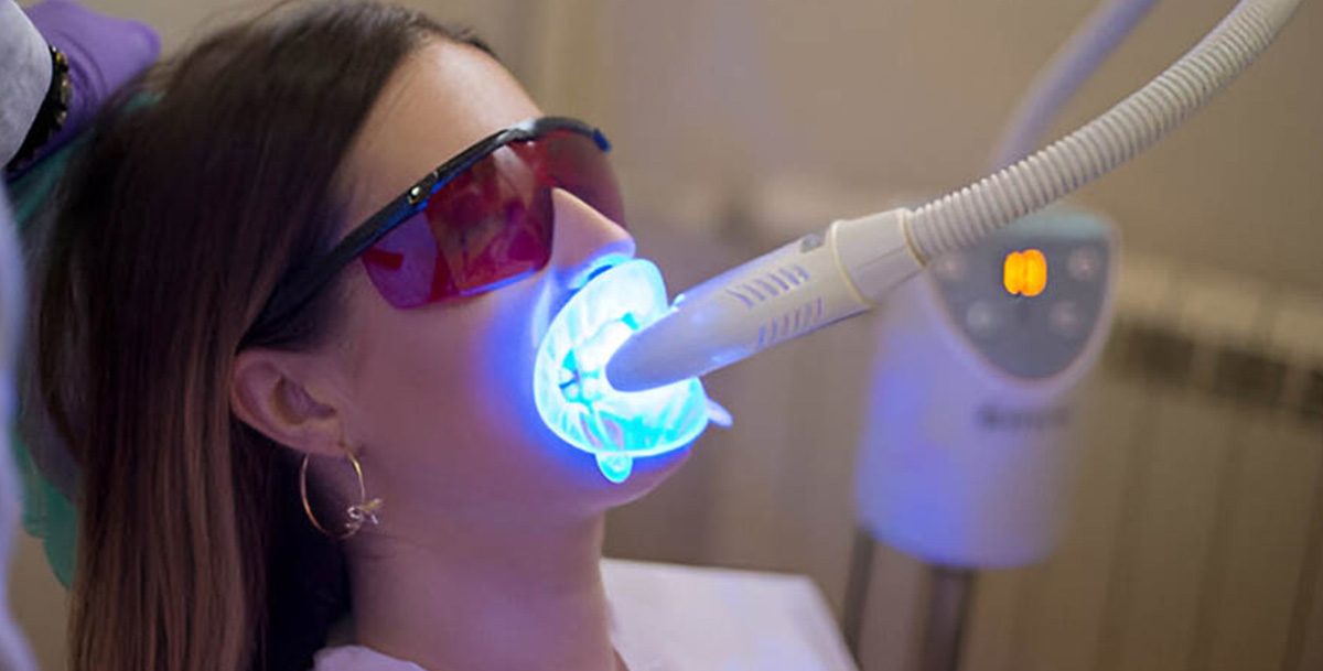 Not Everyone Is a Candidate for Whitening