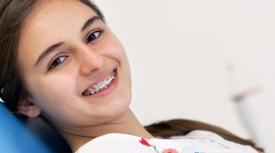 Paediatric Orthodontics in Gurgaon
