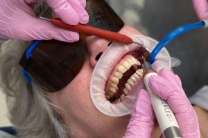 GBT (Guided Biofilm Therapy) and Its Benefits