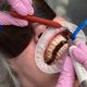 GBT (Guided Biofilm Therapy) and Its Benefits