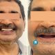 The Best Dental Implant Clinic Near Me in Gurgaon