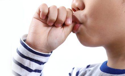 Thumb Sucking and Its Effect on Teeth