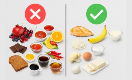 10 Foods to Avoid While Wearing Braces