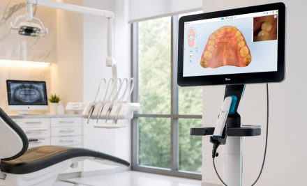 Lumina Scan for Invisalign in Gurgaon