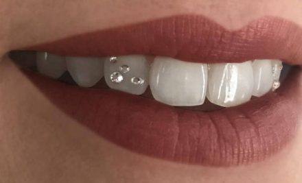 Tooth Jewellery in Gurgaon