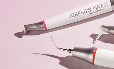 Why Should You Opt for Airflow (GBT) Instead of Regular Scaling?