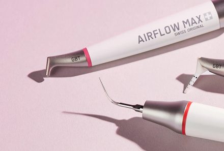 Why Should You Opt for Airflow (GBT) Instead of Regular Scaling?