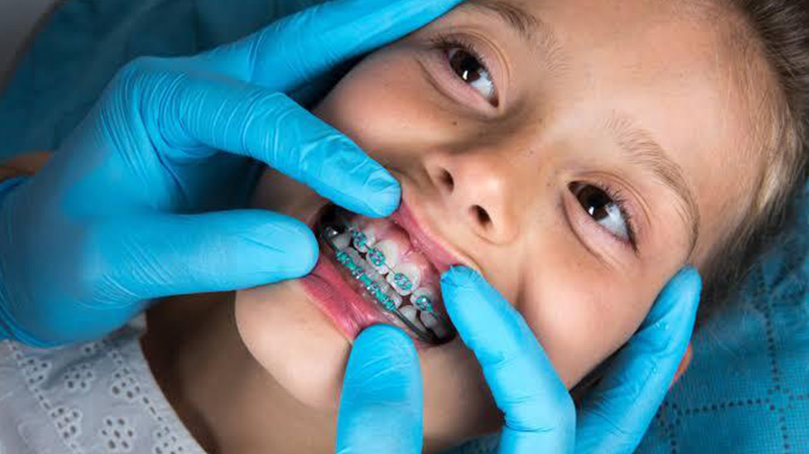 Best Age to Get Braces in Gurgaon