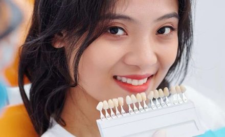 Why Alignment is Important Before Veneers