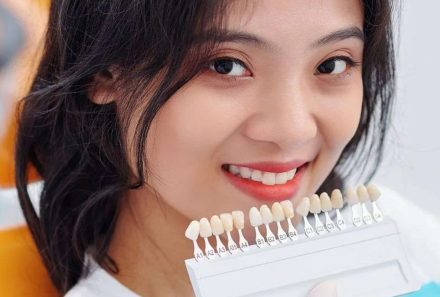Why Alignment is Important Before Veneers