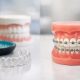 Ceramic Braces vs Invisible Aligners